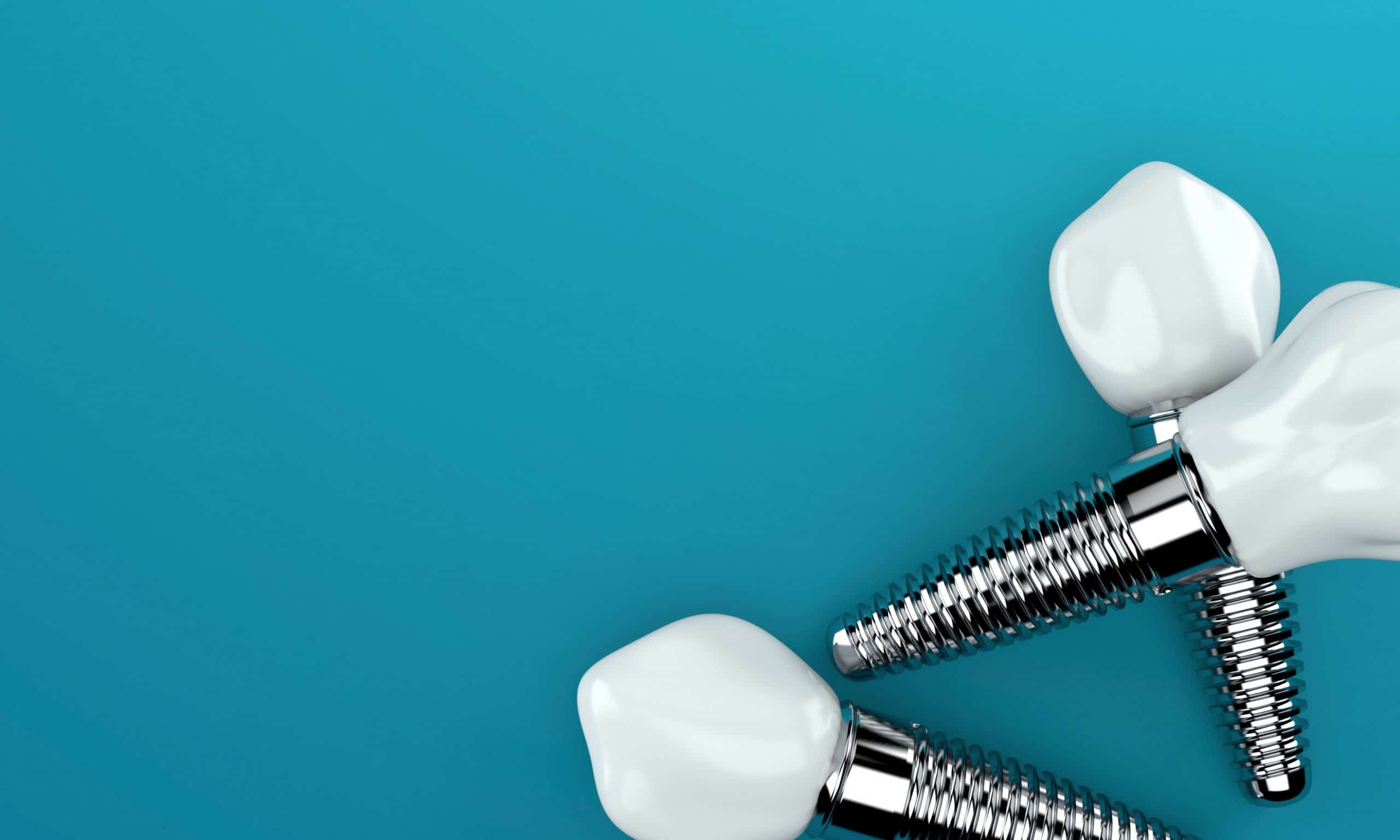 understanding dental implants
