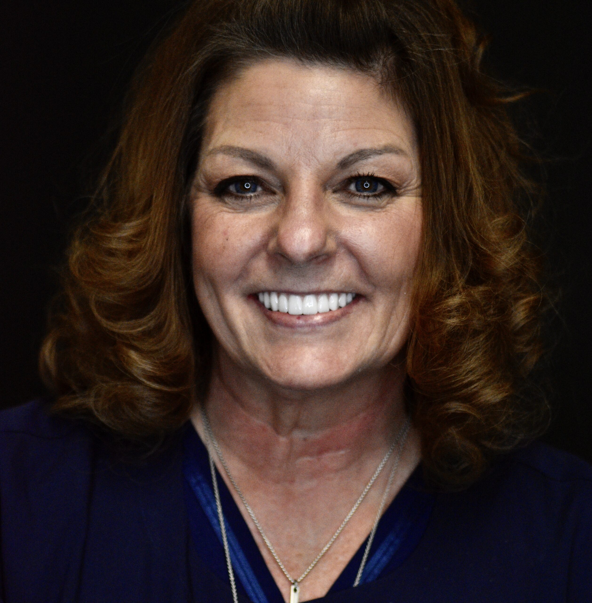 smiling dental implant patient